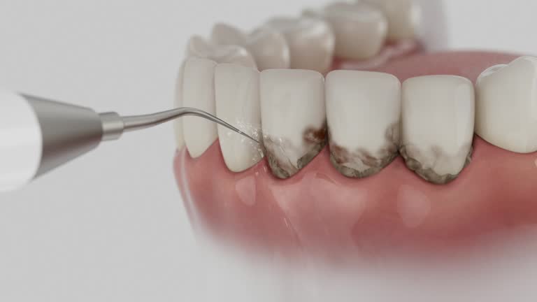 Reliable Dental Implants contractor in Halifax, VA by Smile Center Dentistry